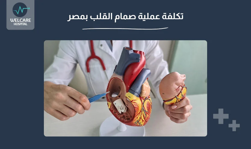 تكلفة عملية صمام القلب بمصر