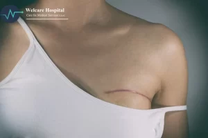 أنواع عملية اعادة بناء الثدي في مصر